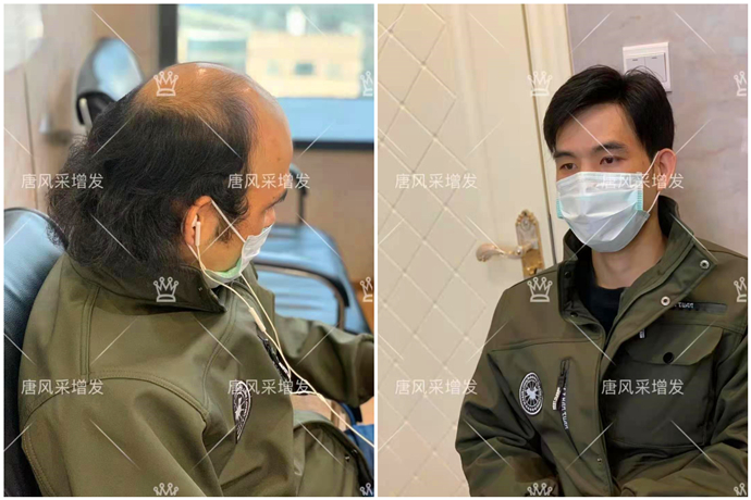 補(bǔ)發(fā)片哪個(gè)牌子好 \