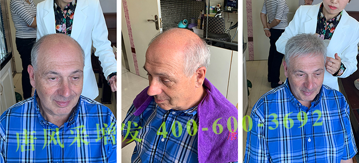 假發(fā)私人定制好在哪 \