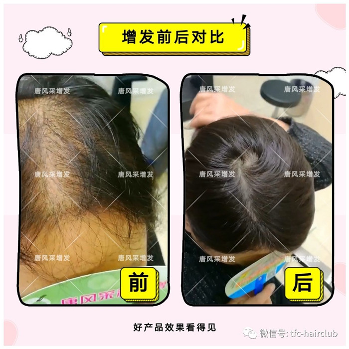 最逼真的假發(fā)套 \