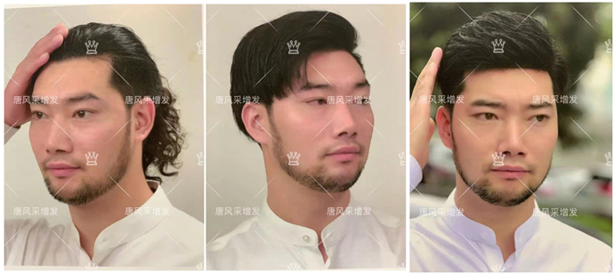 隱形男士假發(fā) \