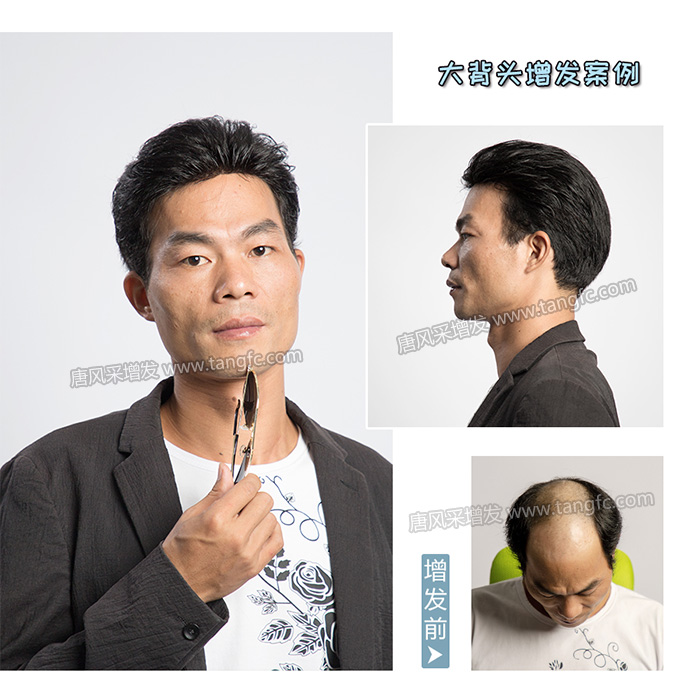 男士假發(fā)定制 \