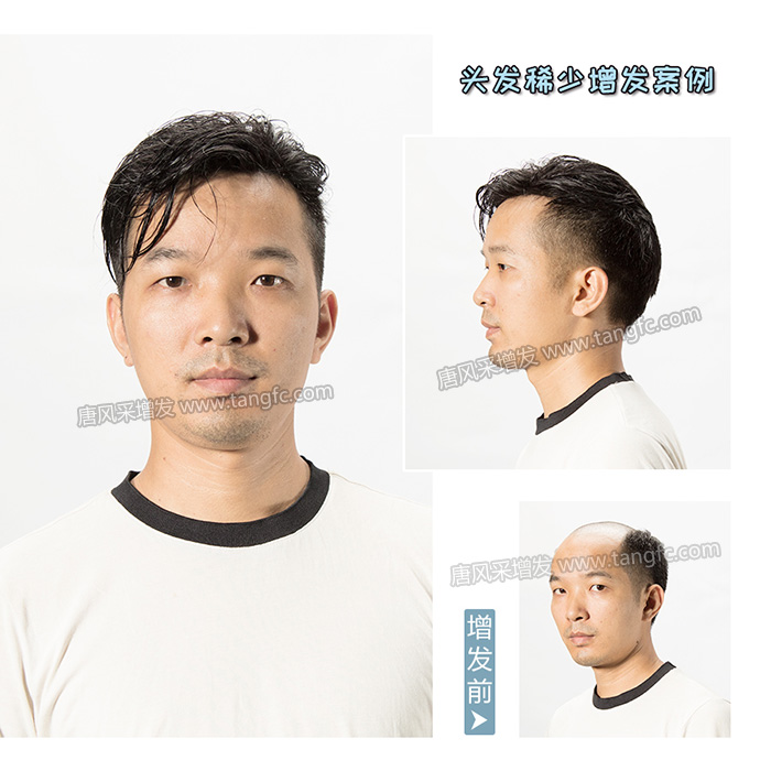 男士假發(fā)定制 \