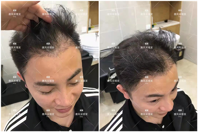 做隱形增發(fā) \