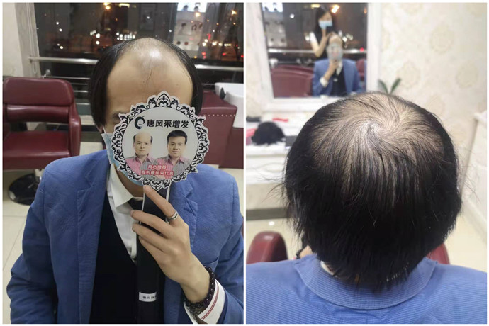 做隱形增發(fā) \