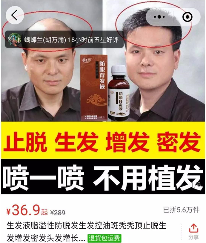 生發(fā)產(chǎn)品 \