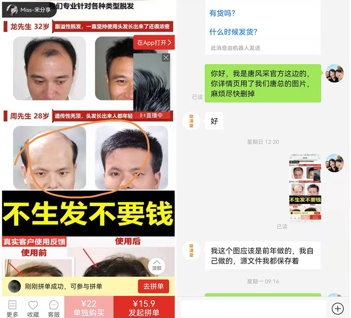 生發(fā)產(chǎn)品 \