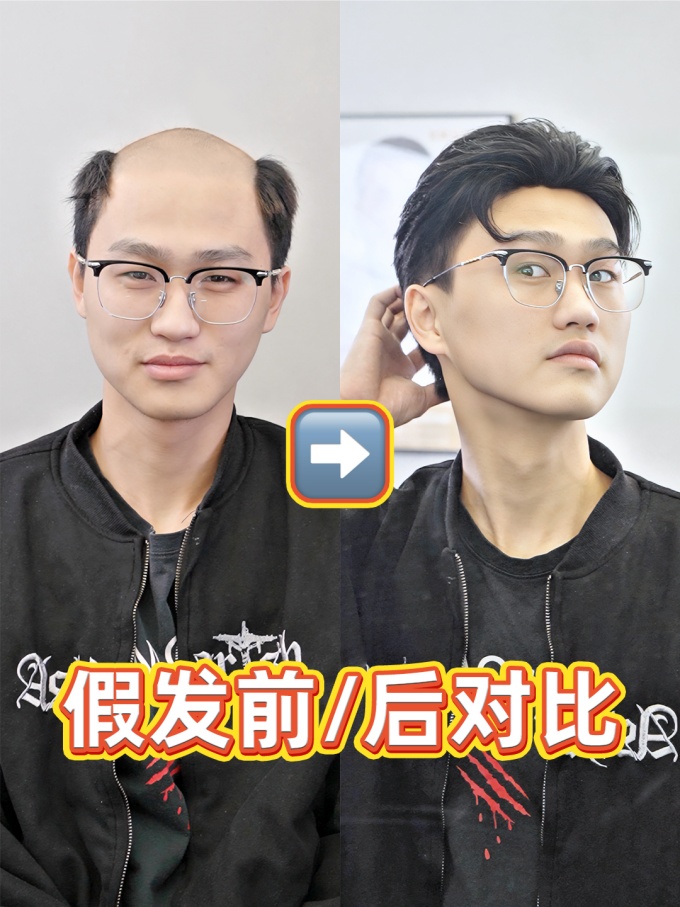 貴陽(yáng)假發(fā)哪家好,假發(fā)效果 \