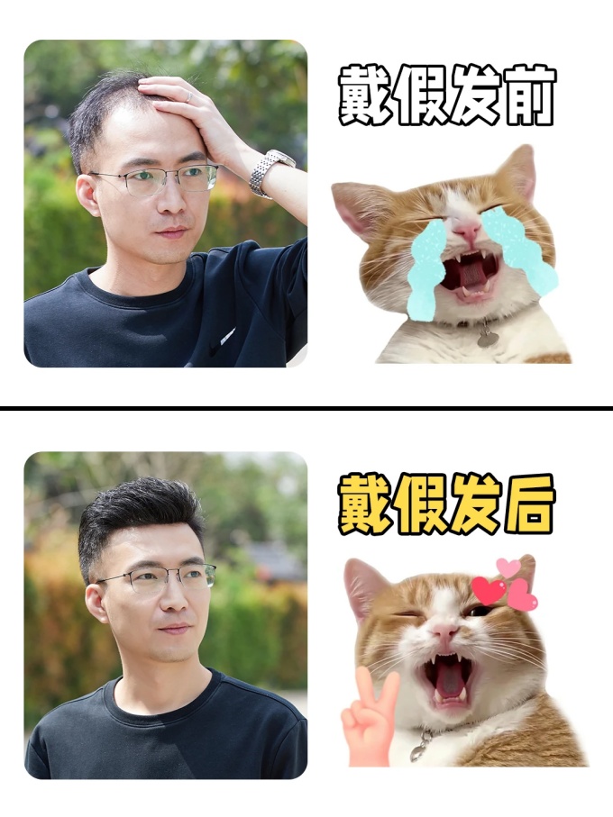 頭頂難題,假發(fā)專業(yè)定制 \